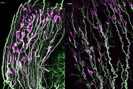 sensory nerve cell strands in green and pink.