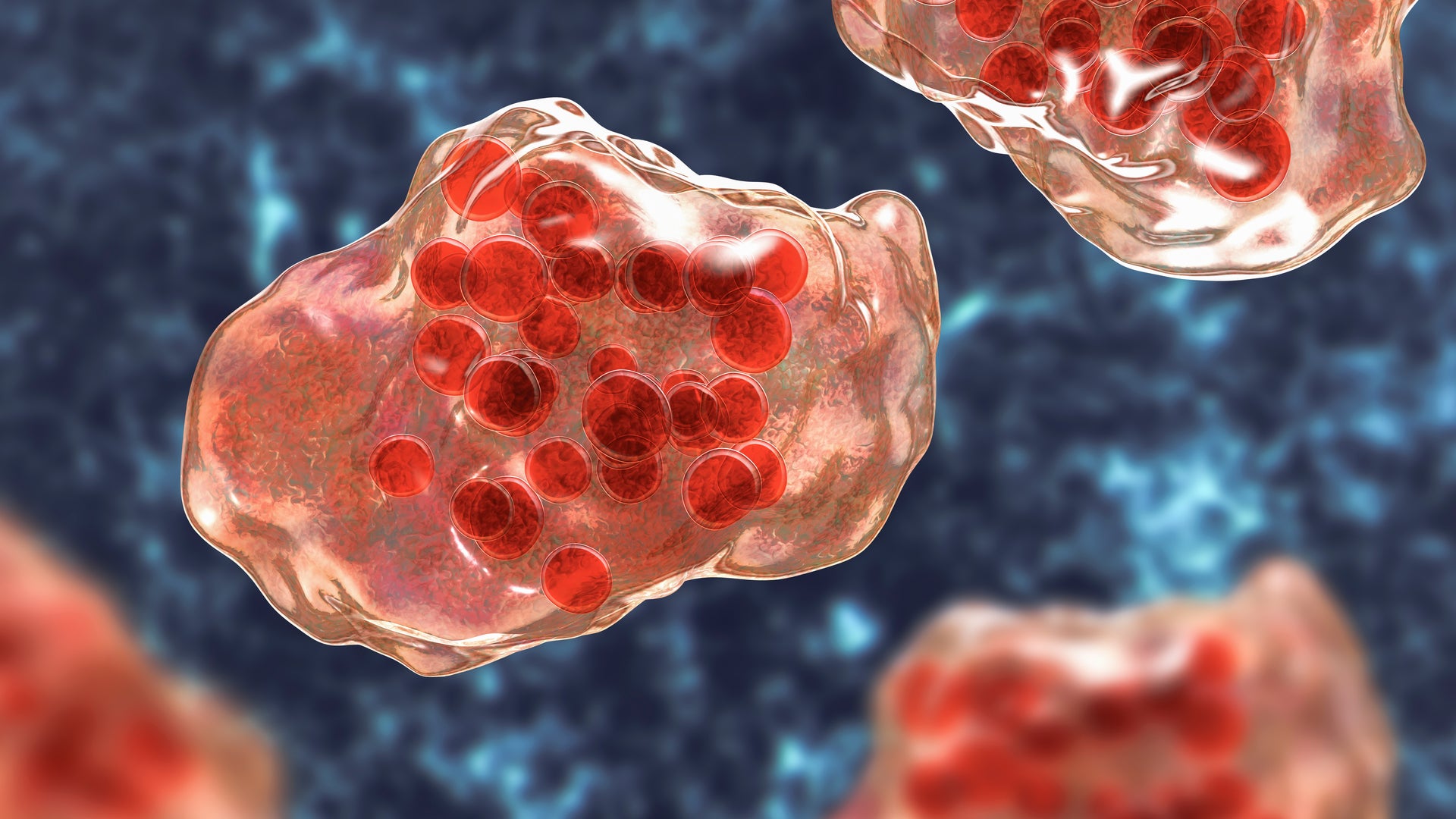 Florida Surgeon General Risks Making a Dangerous Measles Outbreak Much  Worse | Scientific American
