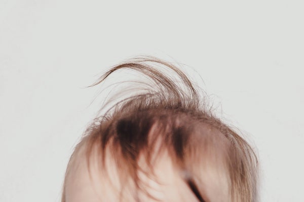 Photograph of hair sticking straight up on top of a baby's head due to cowlick