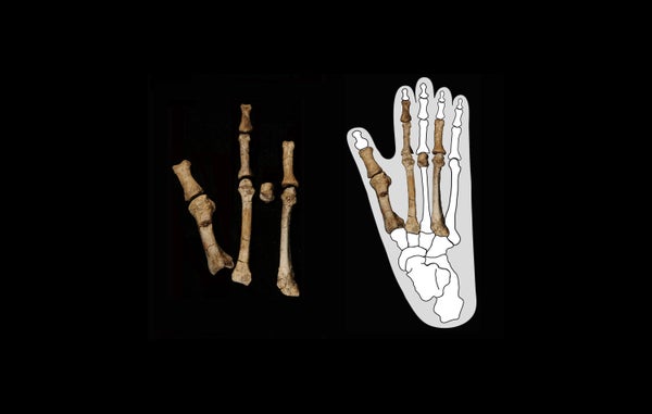 On the left, a collection of bones arrayed against a black background. On the right, that same array is positioned atop a diagram of a foot's skeleton and flesh.