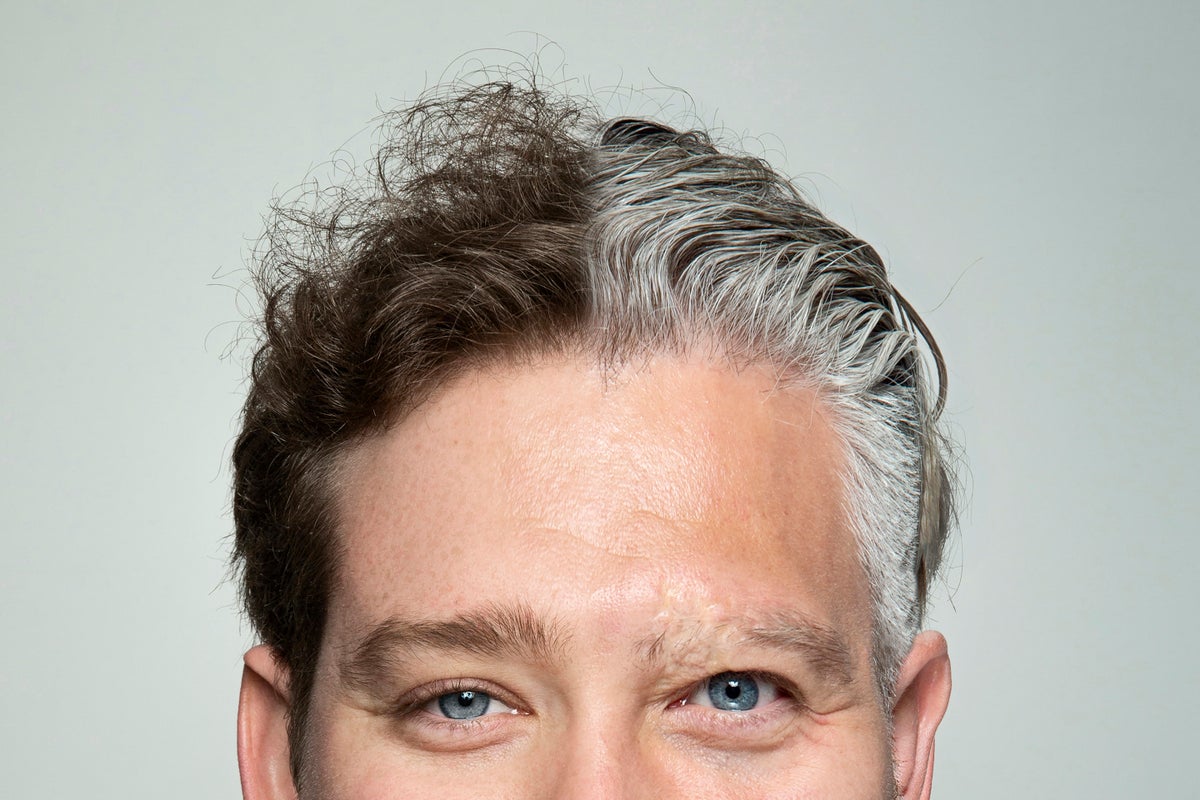 Photo illustration, split image portrait of man's upper face and head, the left half younger, appearing to be aged around 30s or 40s, the right half older with grayed hair appearing to be about 60 years old