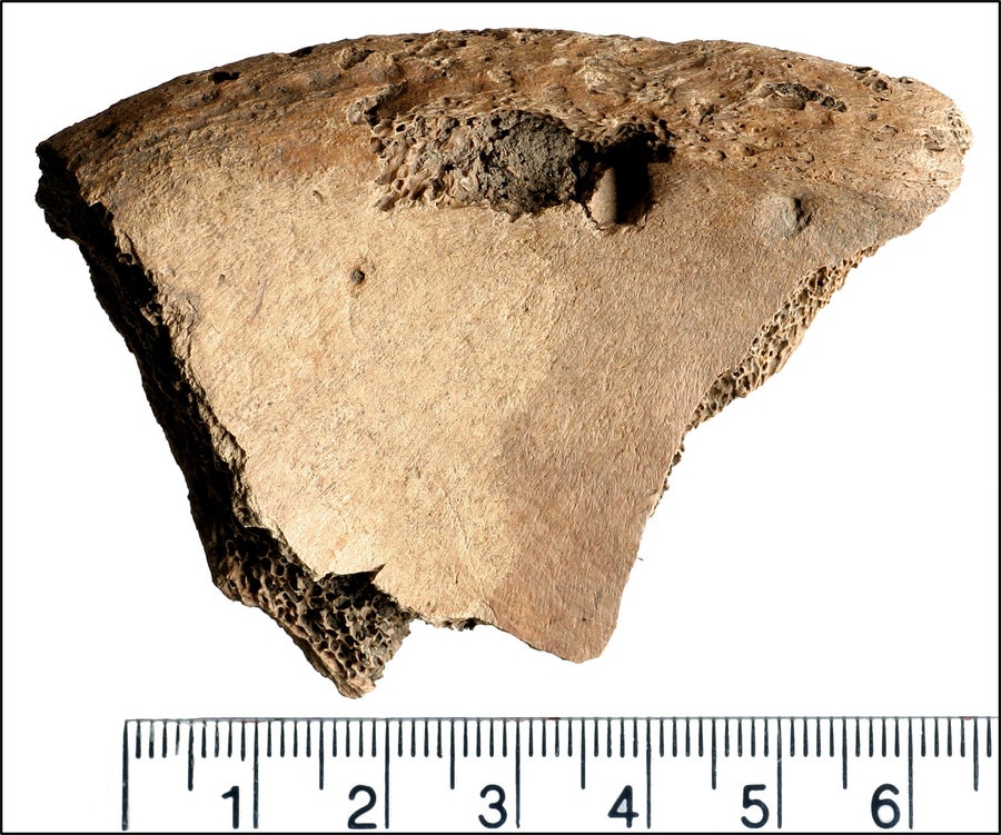 Photo figure from study showing lesion on the left iliac spine of 6DT19