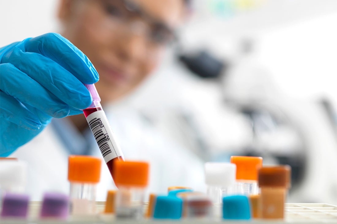 A lab technician lifting up a vial