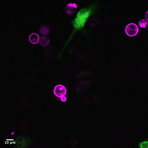 Cell highlighted green energetically consumes cells highlighted in pink