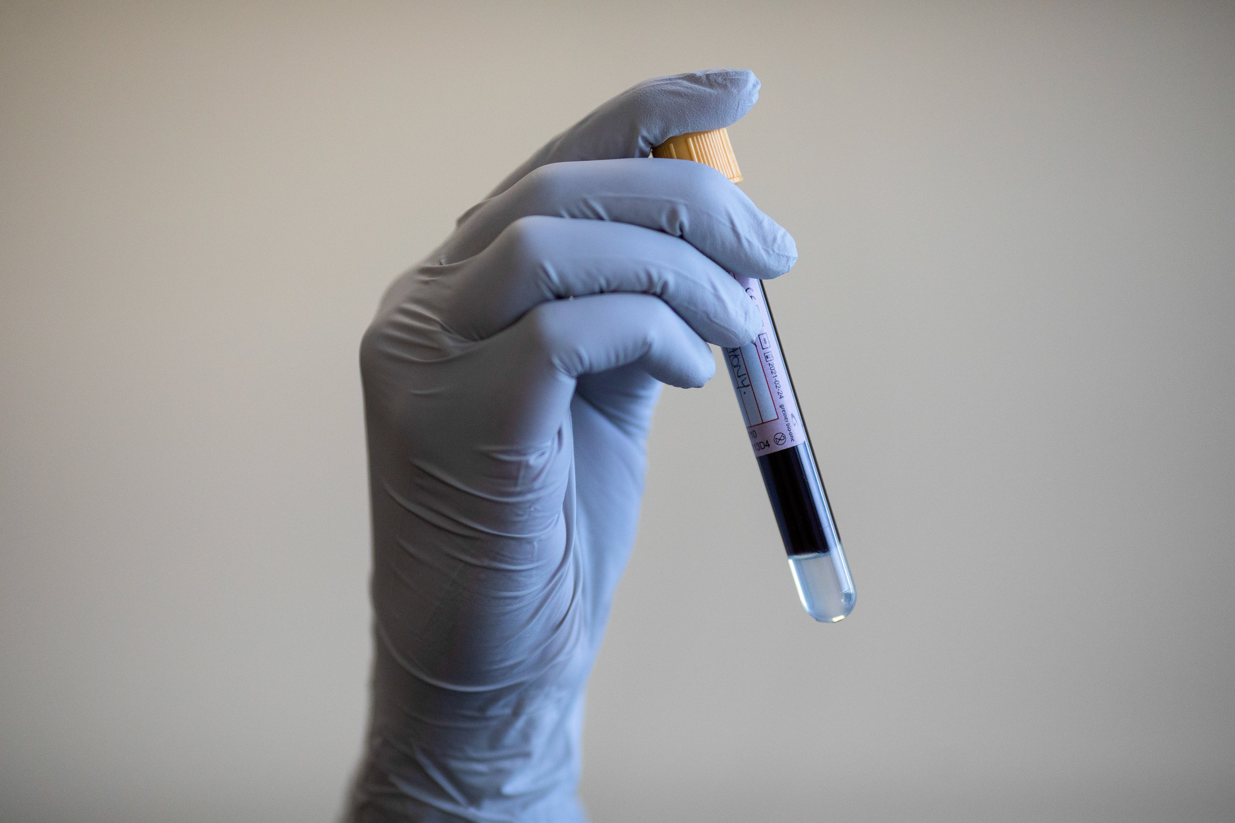 Gloved hand holds blood sample in vial