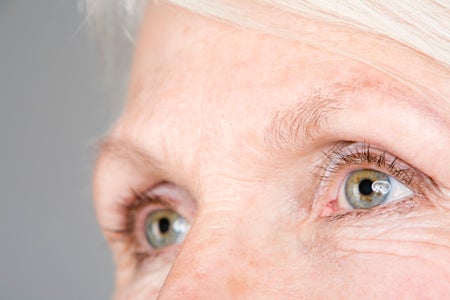 Close up of a woman with hazel and blue eyes and white hair