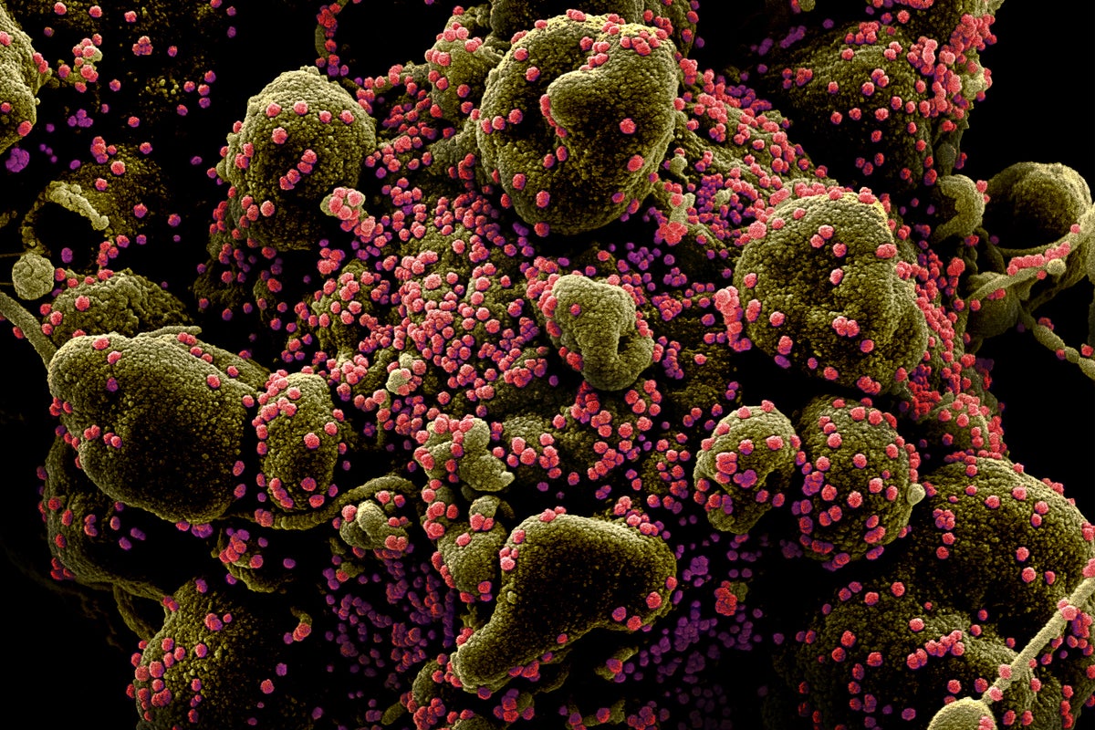 COVID Research Funding to Be Slashed, NIH Documents Show