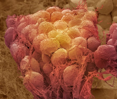 a microscope image of fat cells colored red and yellow