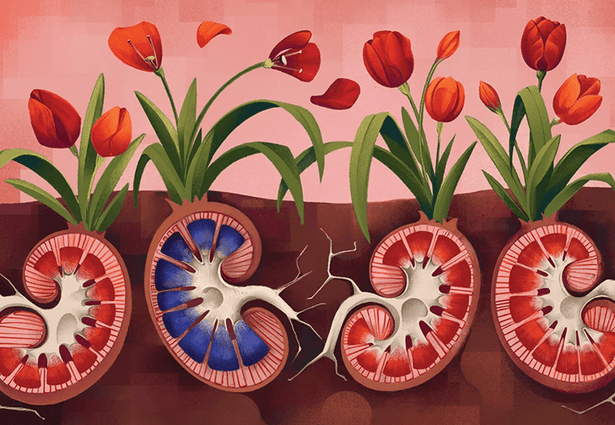 Illustration of kidneys as the root of plants. One is rotting.