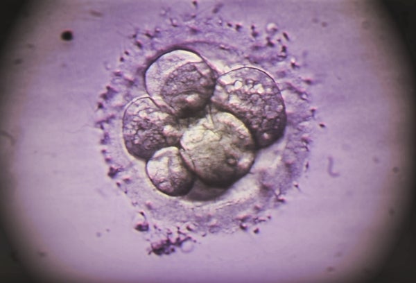Alabama’s Embryo Personhood Decision Threatens Patients, Medicine and Advances in IVF