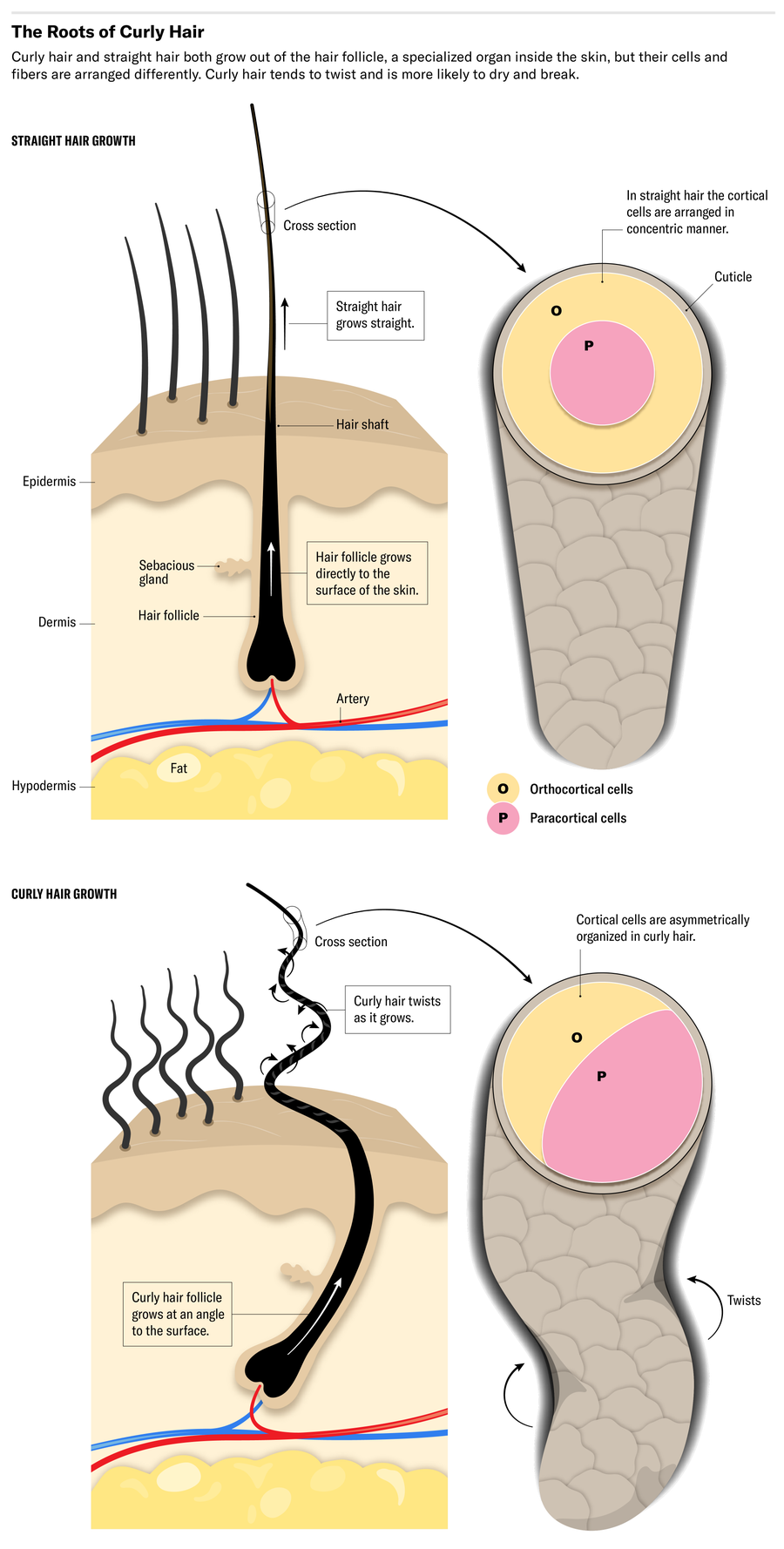 https://static.scientificamerican.com/dam/m/30a6ad0f98de6f06/original/SciAm-Curly-hair-figure-v2.png?m=1721760082.344&w=900