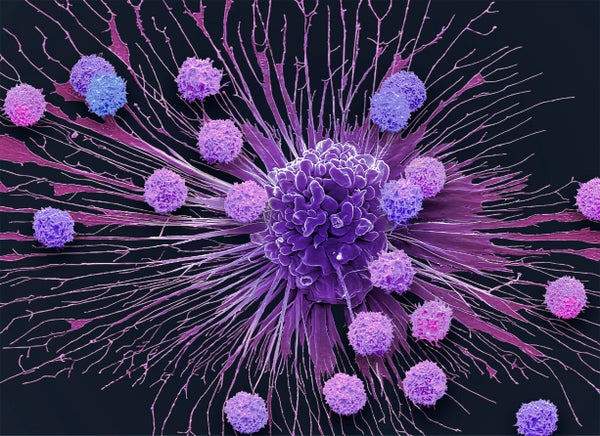 CAR T-cells (small round) attack an apoptotic cervical cancer cell (Hela), showcasing immune system’s precision in targeting tumors.