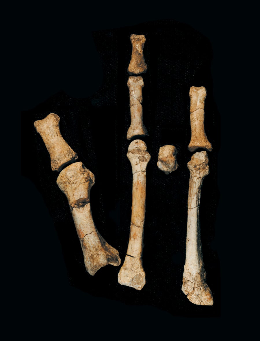 Remains and bones of a foot against a black background