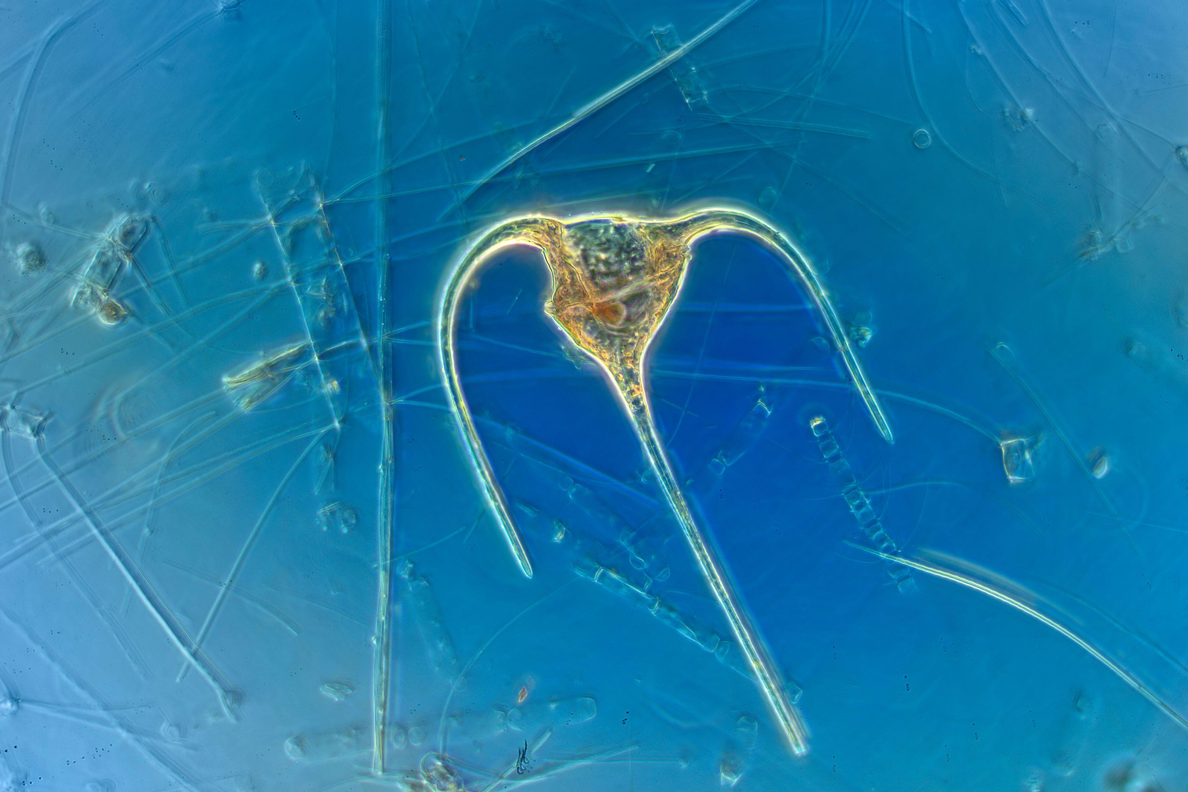 Micrograph of marine phytoplankton, dinoflagellate, Tripos muelleri