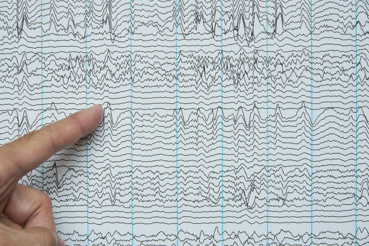 From Diagnosing Brain Disorders to Cognitive Enhancement, 100 Years of EEG Have Transformed Neuroscience