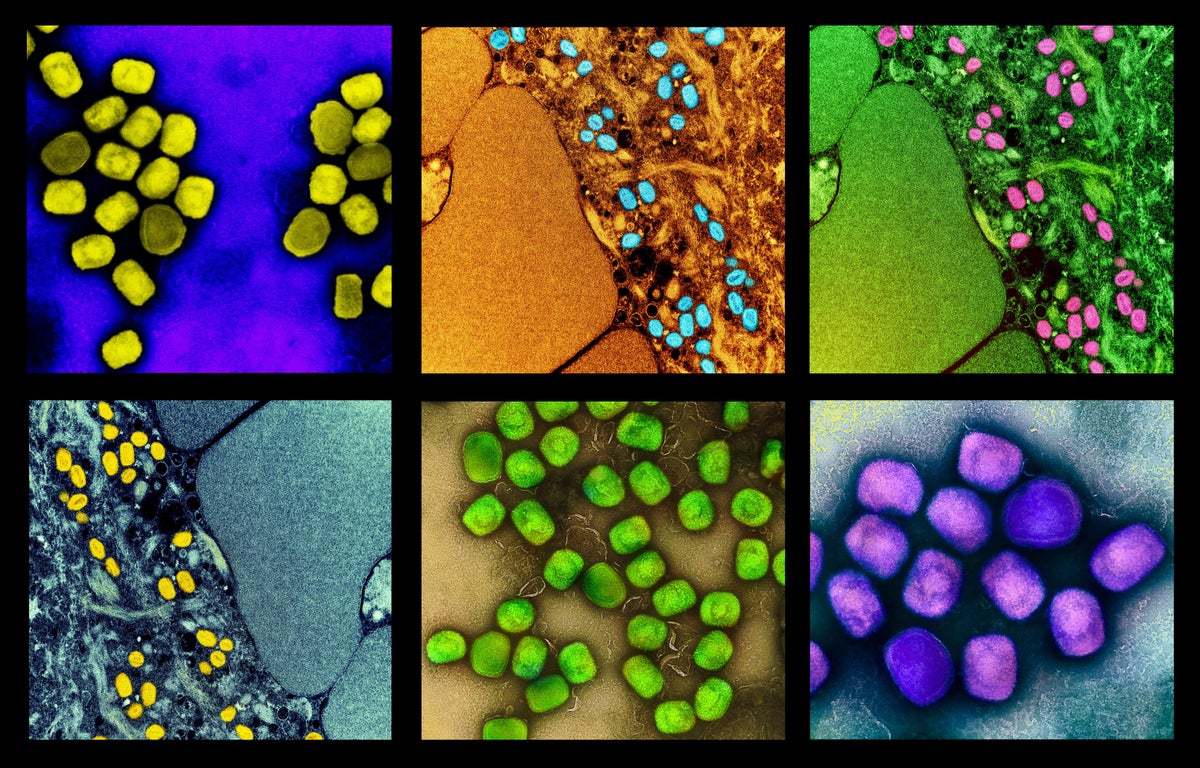 The WHO Declared Mpox a Global Health Emergency. Here's Where the Virus Is Spreading and What Vaccines and Treatments Exist