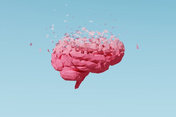 A low-polygon human brain dissolves from top to bottom, visually representing the progression of memory loss.