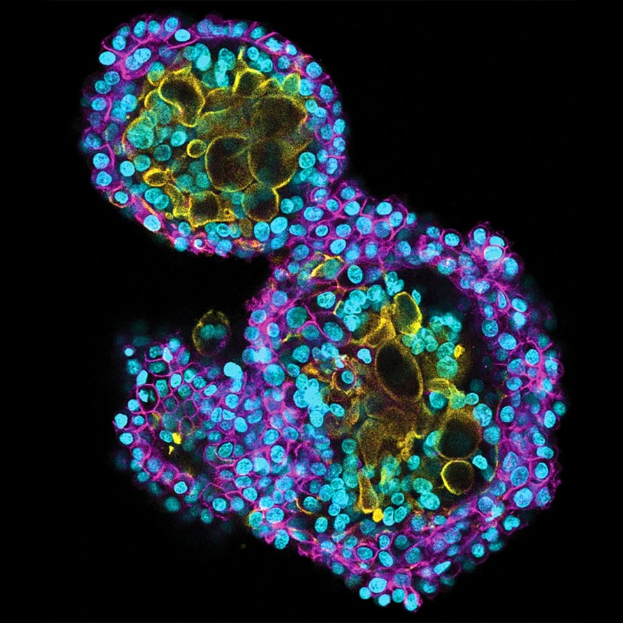 Micrograph showing blue and purple cells in a rough figure 8, surrounding blue, green and yellow cells