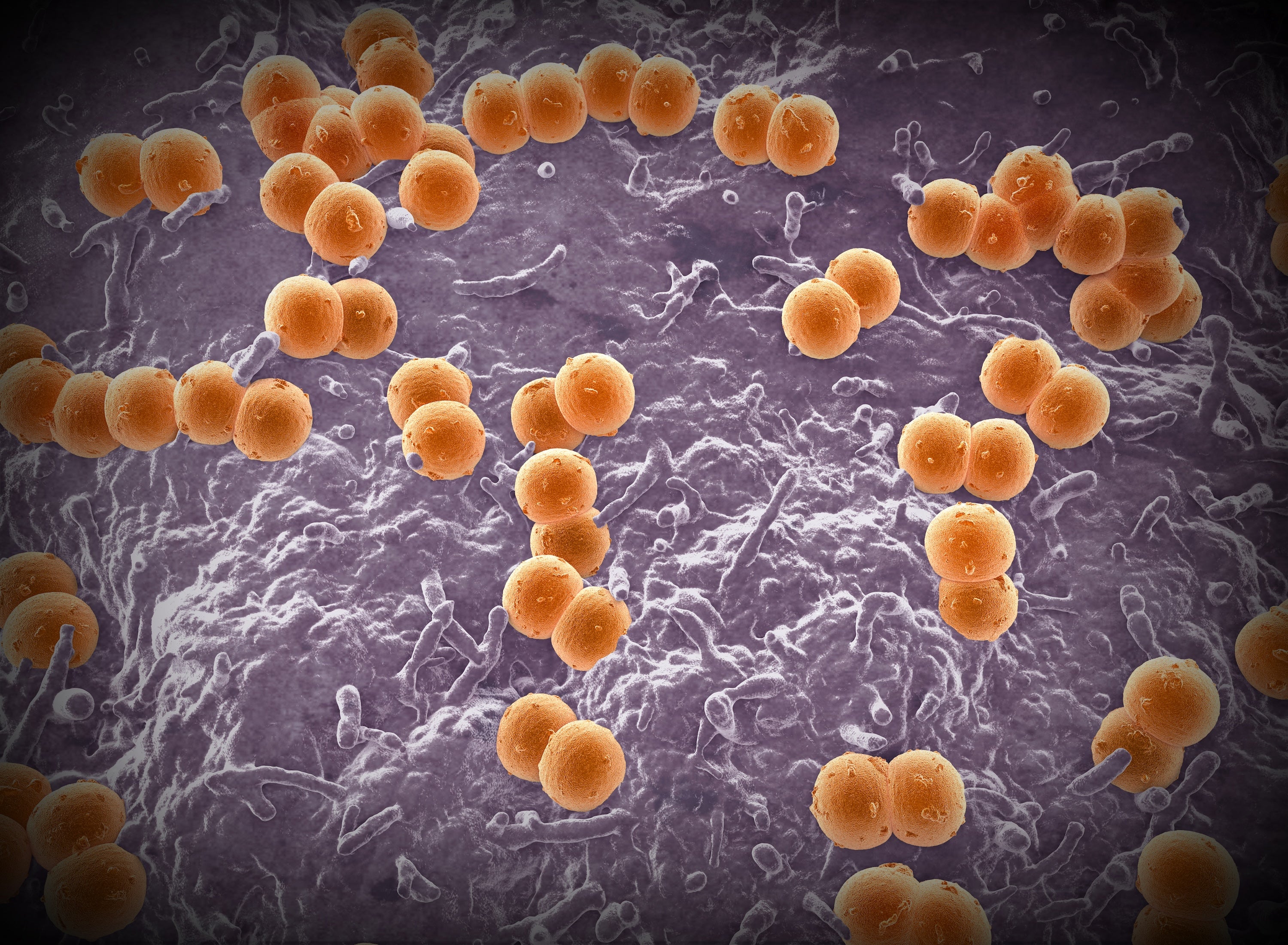 illustration of bacteria species Neisseria meningitidis which are colored orange and are spherical