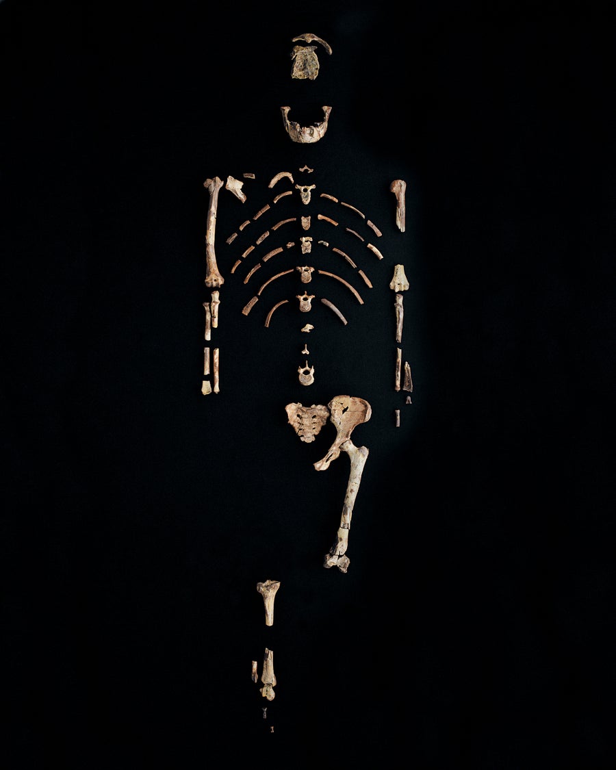 Remains of a skeleton against a black background