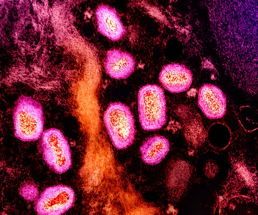https://static.scientificamerican.com/dam/m/452f34b90b13a2a4/original/Monkeypox_colorized_transmission_electron_micrograph.jpg?m=1730478559.528&w=900