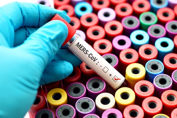 Close-up of a MERS coronavirus test