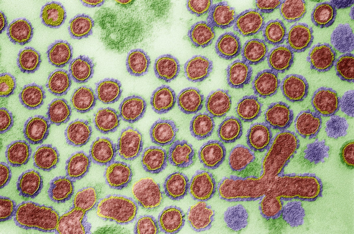 Color enhanced transmission electron microscope image (TEM) of Avian Influenza (Bird Flu). Highly Pathogenic Avian Influenza (HPAI) variants such as H