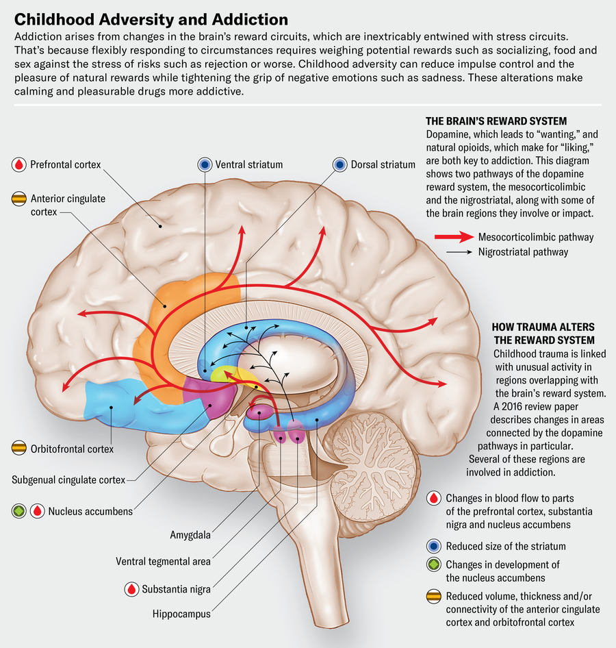 Brain diagram shows two pathways of the dopamine reward system, the mesocorticolimbic and the nigrostriatal, along with regions they involve or impact. The brain is annotated with unusual activity associated with childhood trauma—including changes in blood flow and size reduction—that is linked with unusual activity in those regions.