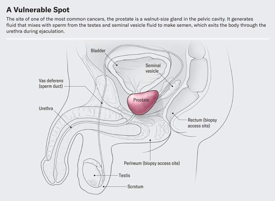 The cutting illustration shows the position of the prostate, a gland of the size of walnut in the pelvic cavity. It generates liquid that is mixed with sperm of the testicles and the liquid of seminal vesicles to make semen, which comes out of the body through the urethra.