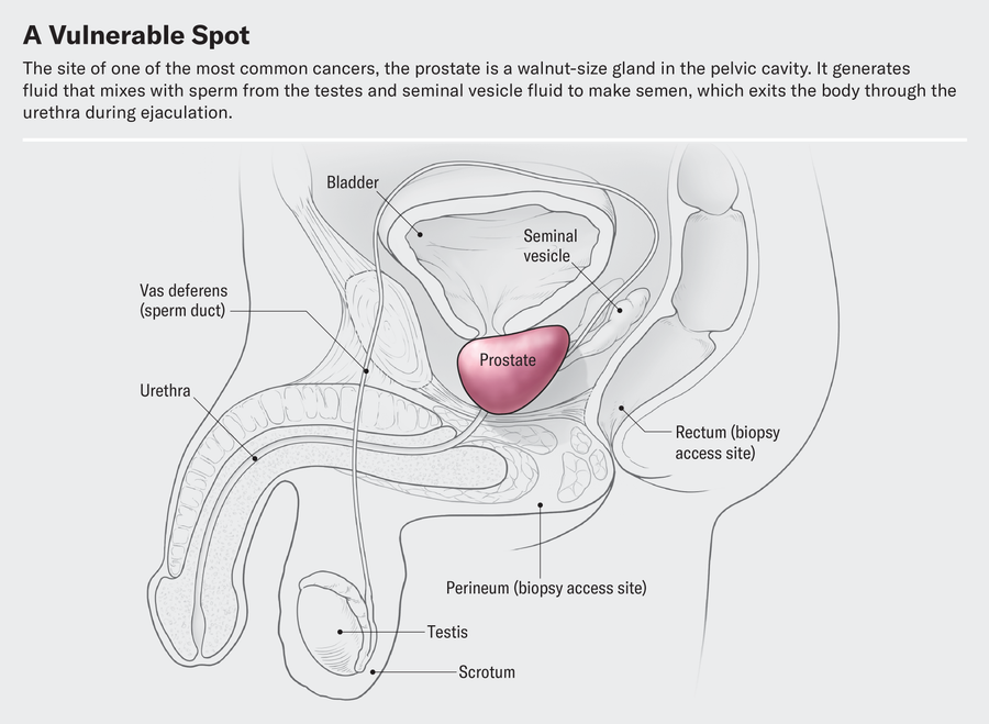 Cutaway illustration shows the position of the prostate, a walnut-size gland in the pelvic cavity. It generates fluid that mixes with sperm from the testes and seminal vesicle fluid to make semen, which exits the body through the urethra.