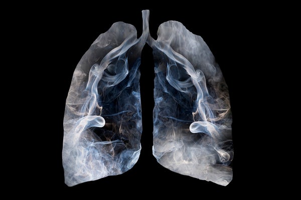 Scan of lungs