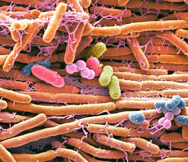 Colored scanning electron micrograph (SEM) of bacteria cultured from a mobile phone