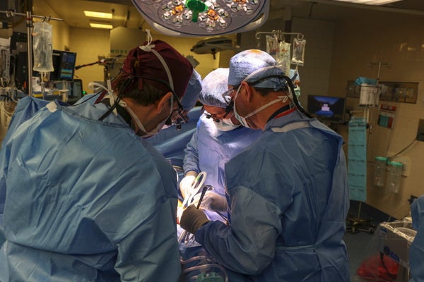 Four surgeons performing a transplant in an operating room
