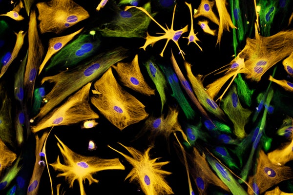 Fluorescence light micrograph of neural progenitor cells. Astrocytes have been stained orange and neural progenitor cells green. Cell nuclei are blue