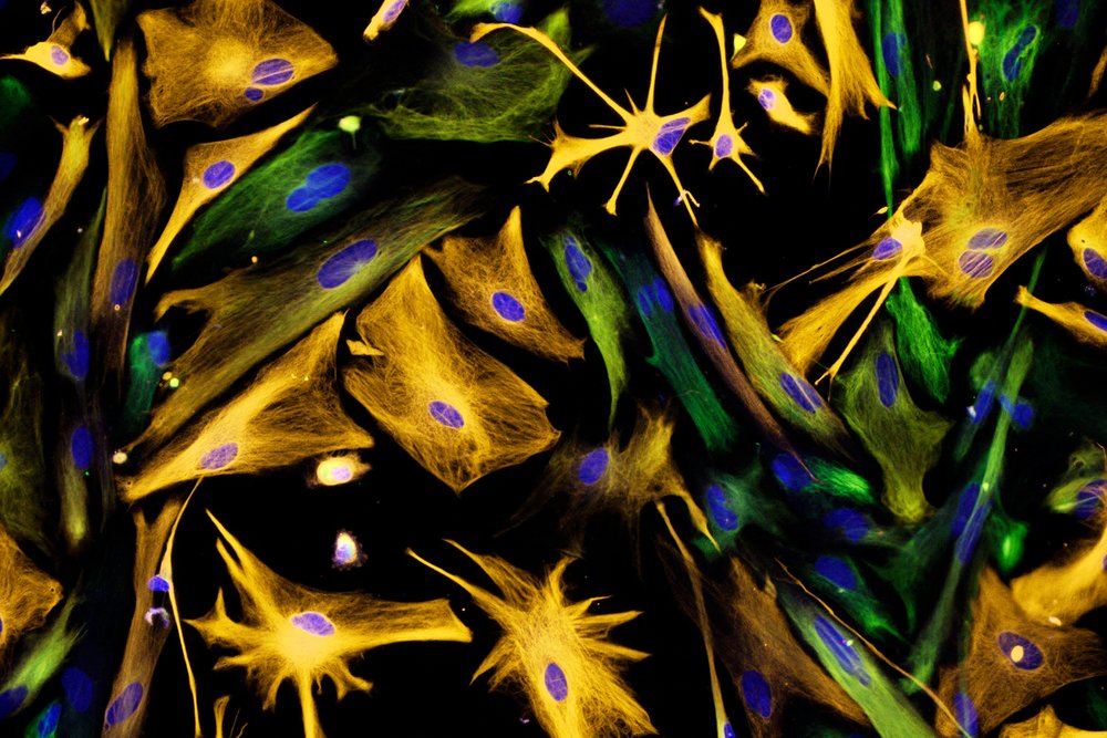 Micrografía de luz de fluorescencia de células progenitoras neurales. Los astrocitos se han teñido de naranja y las células progenitoras neurales de verde. Los núcleos celulares son azules.