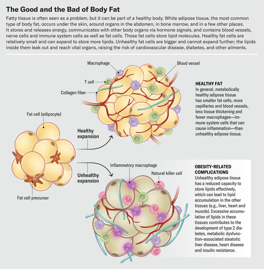 Graphic shows what healthy versus unhealthy expansion of fat cell precursors looks like at the cellular level.