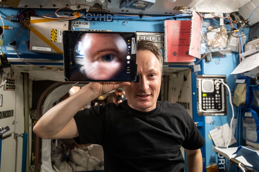 A man using an ophthalmic lens attached to a tablet to send pictures of his retina