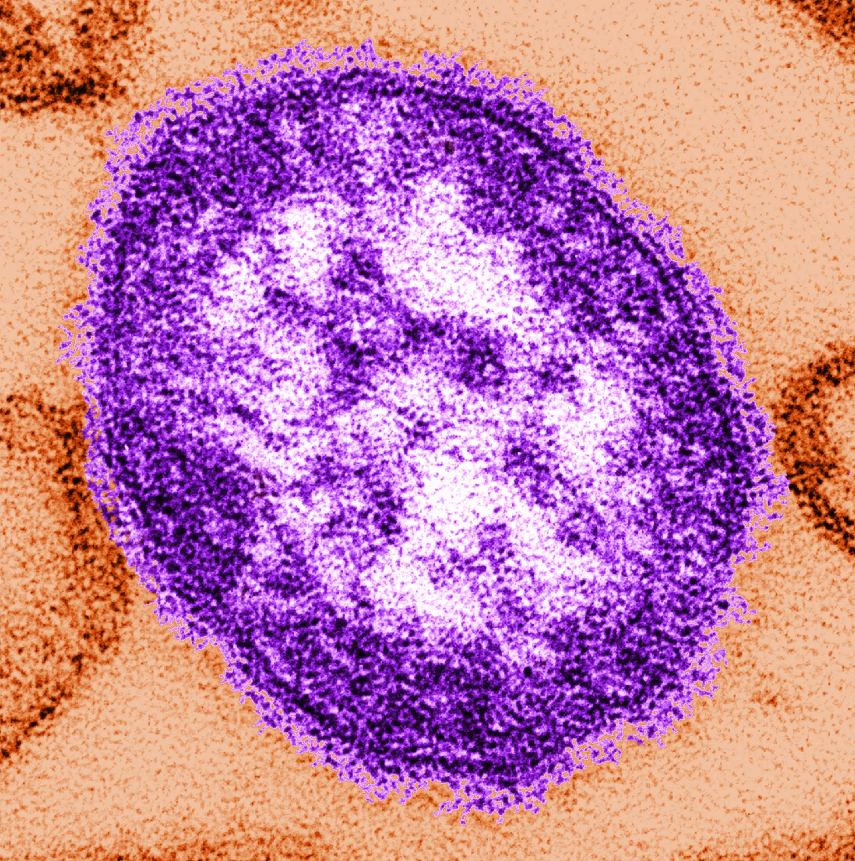 Microscope image of a measles virus