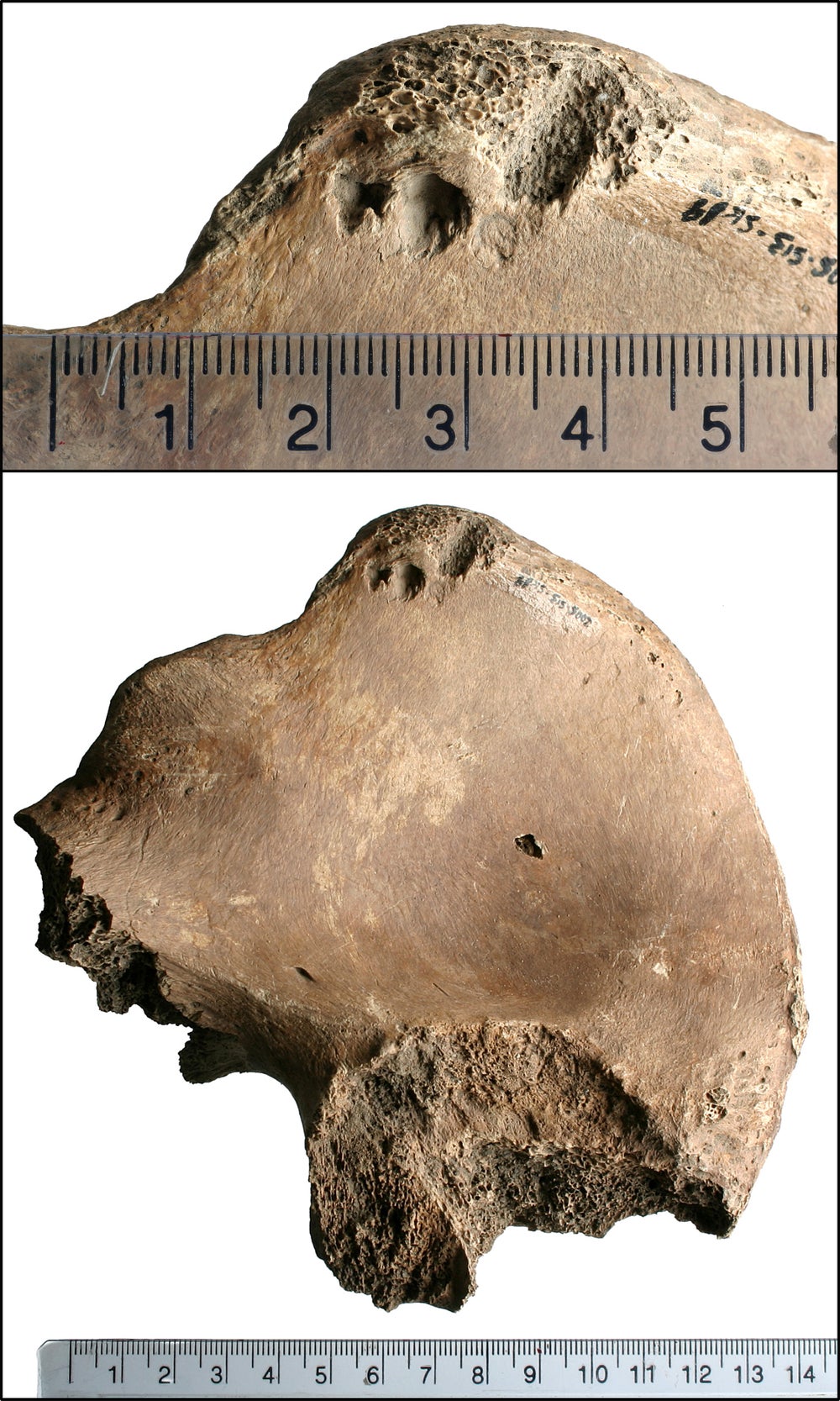 Figura fotográfica del estudio que muestra la lesión en el ilium derecho de 6DT19