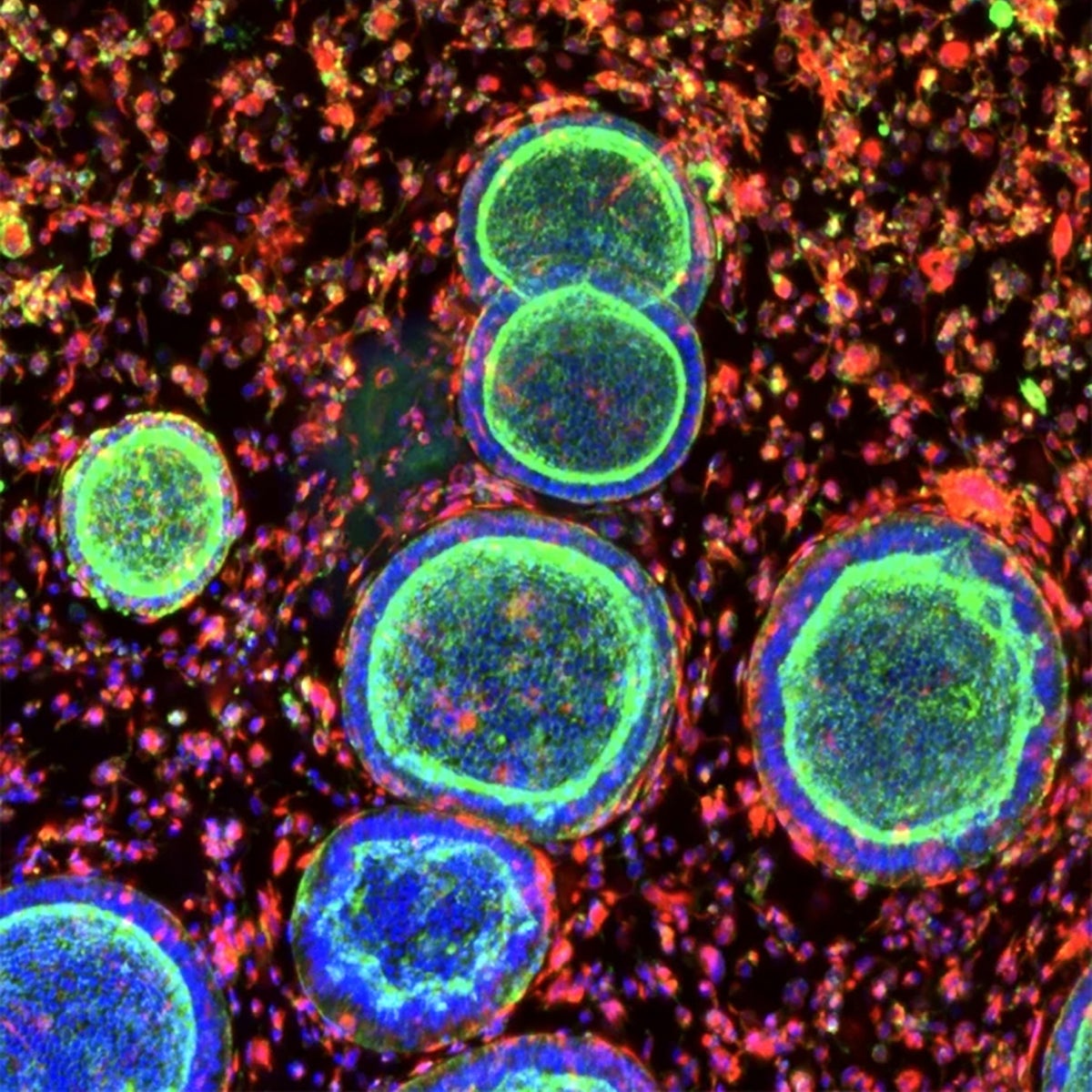 Lab-Made Mini Organs Could Transform Female Reproductive Medicine