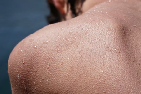 Wet cold skin with goose bumps on a person's back and shoulder