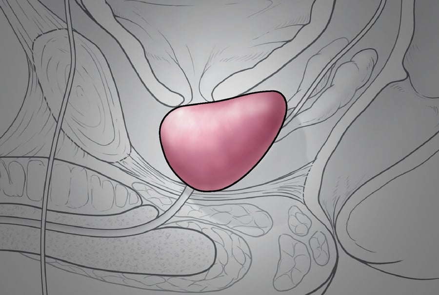 Cutaway illustration shows the position of the prostate, a walnut-size gland in the pelvic cavity. It generates fluid that mixes with sperm from the testes and seminal vesicle fluid to make semen, which exits the body through the urethra.