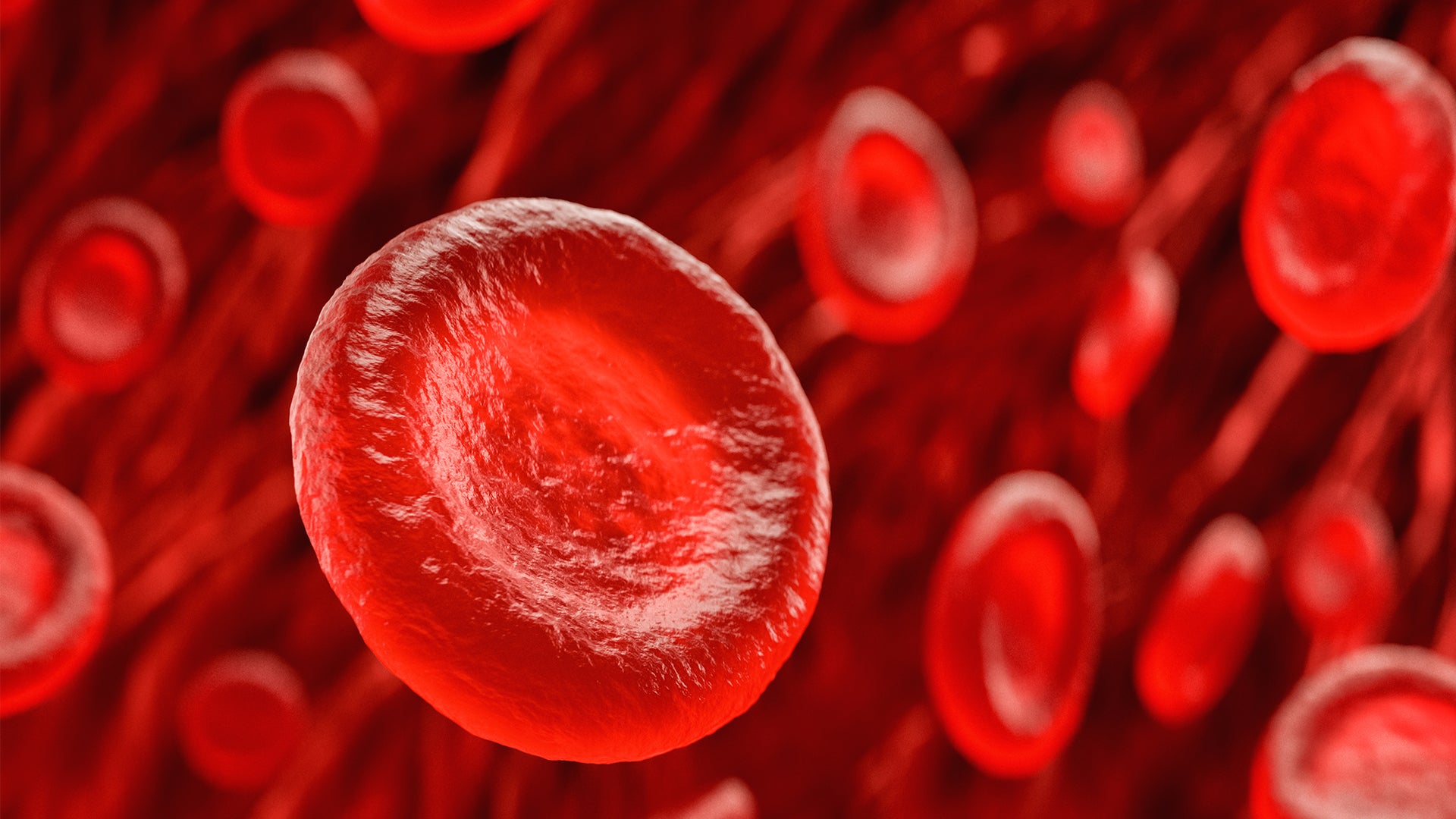 Innovative Thinking Could Make New Sickle Cell Treatments More Accessible | Scientific American Innovative Thinking Could Make New Sickle Cell Treatments More Accessible | Scientific American