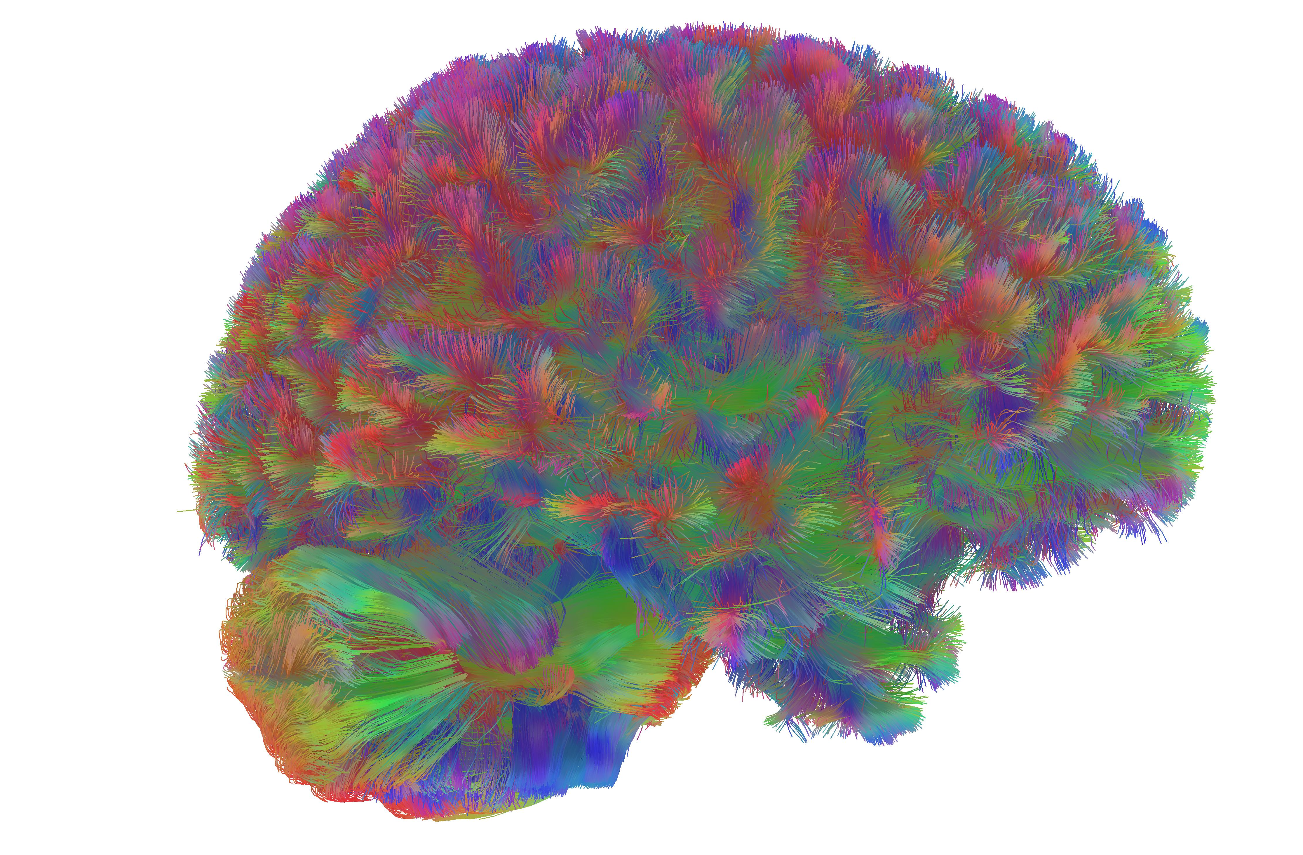 10 Mind Blowing Brain Discoveries From 2025 Scientific American 10 Mind Blowing Brain Discoveries From 2025 Scientific American