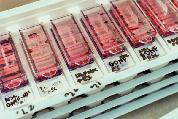 Close up photograph of stacked plastic trays in a research lab containing human cells, handwriting in sharpie identifies samples in each of the trays' compartments