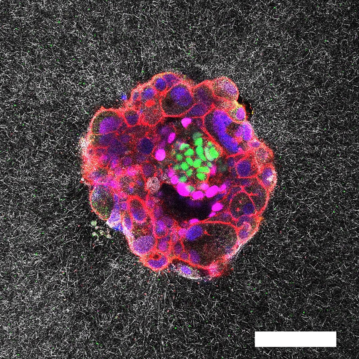 Implantation Human Embryo Development Human Embryo Implantation