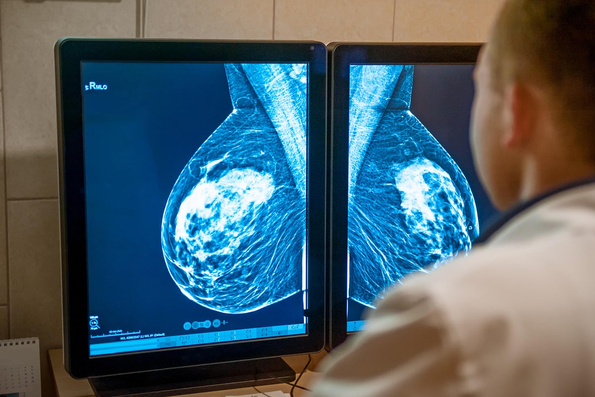 Doctor examines mammogram on monitors