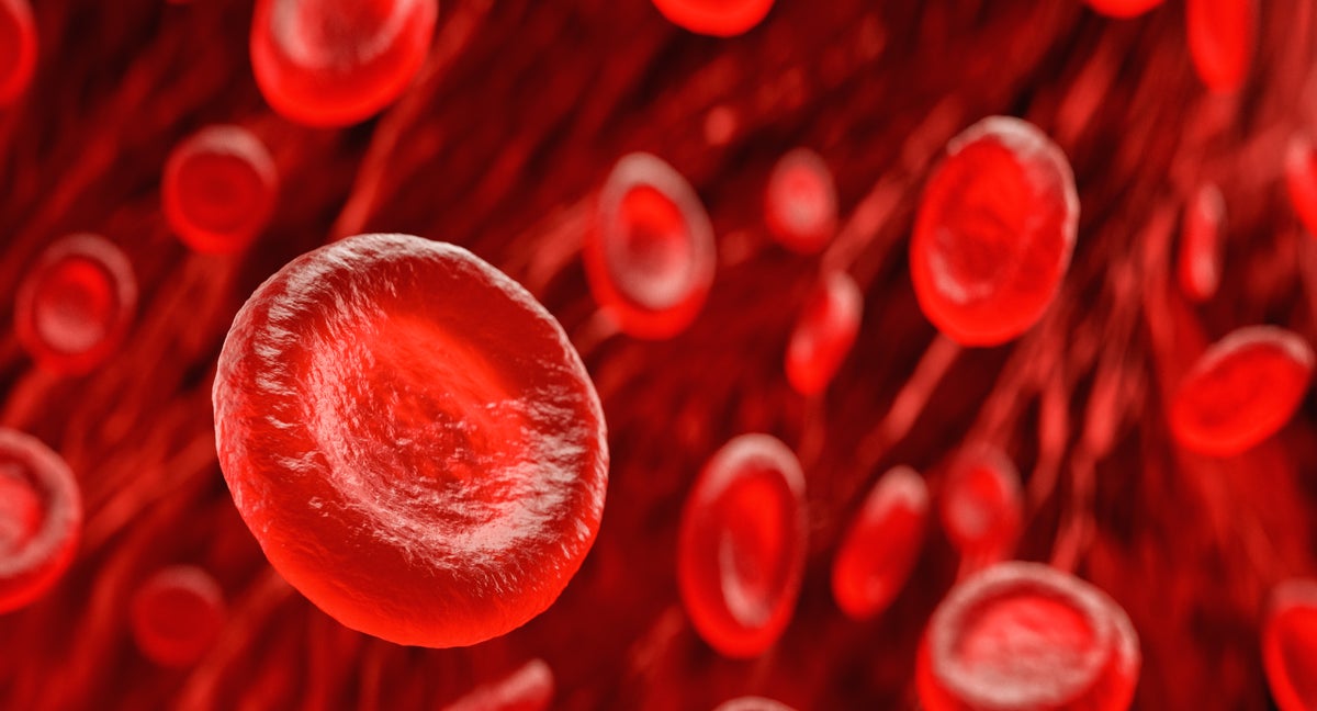 Innovative Thinking Could Make New Sickle Cell Treatments More Accessible