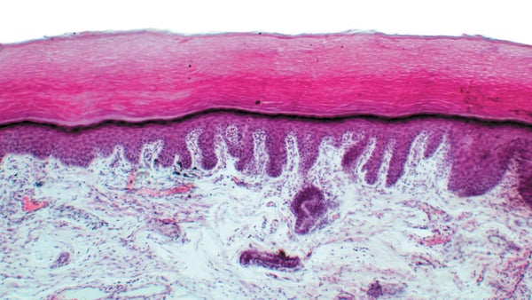 Image of finger tip dyed red