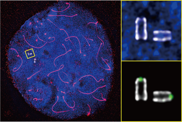 A microscope image shows the pink swirls of chromosome axis against a stained blue background with a couple of small white centrioles. The centrioles look like two parallel lines with faint white connections on either end.